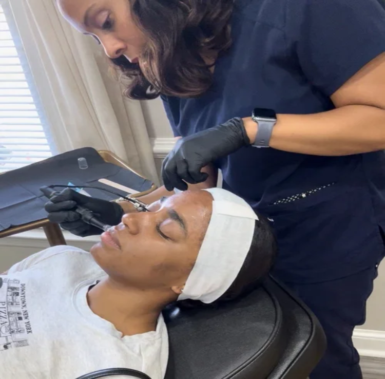 Microneedling nurse